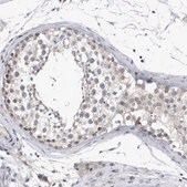 Anti-RBM28 antibody produced in rabbit Prestige Antibodies&#174; Powered by Atlas Antibodies, affinity isolated antibody, buffered aqueous glycerol solution, Ab2
