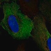 Anti-GPAA1 antibody produced in rabbit Prestige Antibodies&#174; Powered by Atlas Antibodies, affinity isolated antibody, buffered aqueous glycerol solution