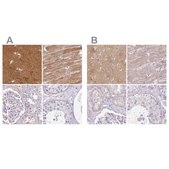 Anti-CAP2 antibody produced in rabbit Prestige Antibodies® Powered by Atlas Antibodies, affinity isolated antibody, buffered aqueous glycerol solution