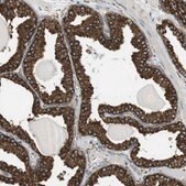 Anti-MBOAT2 antibody produced in rabbit Prestige Antibodies&#174; Powered by Atlas Antibodies, affinity isolated antibody, buffered aqueous glycerol solution