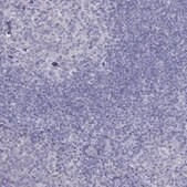 Anti-TDRD6 antibody produced in rabbit Prestige Antibodies&#174; Powered by Atlas Antibodies, affinity isolated antibody, buffered aqueous glycerol solution