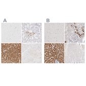 Anti-HMGCS2 antibody produced in rabbit Prestige Antibodies® Powered by Atlas Antibodies, affinity isolated antibody, buffered aqueous glycerol solution