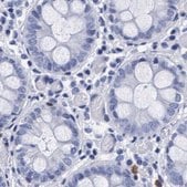 Anti-ARSG antibody produced in rabbit Prestige Antibodies&#174; Powered by Atlas Antibodies, affinity isolated antibody, buffered aqueous glycerol solution, Ab2