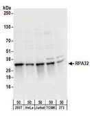 Rabbit anti-RPA32 Antibody, Affinity Purified Powered by Bethyl Laboratories, Inc.