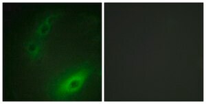 Anti-FOXO1A antibody produced in rabbit affinity isolated antibody