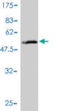 Monoclonal Anti-SLC27A4 antibody produced in mouse clone 1F4-1B10, purified immunoglobulin, buffered aqueous solution