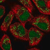 Anti-VRK3 antibody produced in rabbit Prestige Antibodies&#174; Powered by Atlas Antibodies, affinity isolated antibody