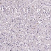 Anti-YAP1 Prestige Antibodies® Powered by Atlas Antibodies, affinity isolated antibody