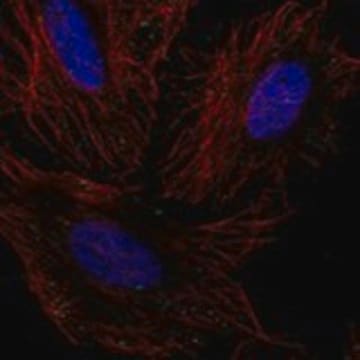 Anti-GLT8D2 antibody produced in rabbit Prestige Antibodies&#174; Powered by Atlas Antibodies, affinity isolated antibody, buffered aqueous glycerol solution