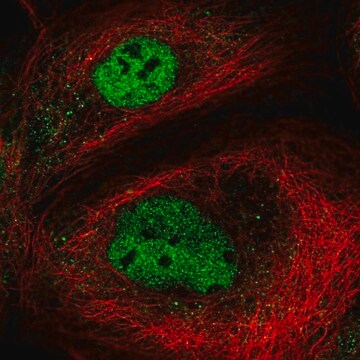 Anti-NEMP2 antibody produced in rabbit Prestige Antibodies&#174; Powered by Atlas Antibodies, affinity isolated antibody