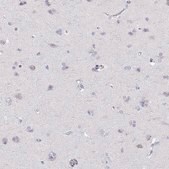 Anti-RGS19 Prestige Antibodies&#174; Powered by Atlas Antibodies, affinity isolated antibody