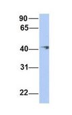 Anti-ERLIN1 antibody produced in rabbit affinity isolated antibody