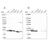 Anti-RPS5 antibody produced in rabbit Prestige Antibodies&#174; Powered by Atlas Antibodies, affinity isolated antibody