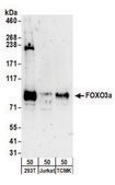 Rabbit anti-FOXO3a Antibody, Affinity Purified Powered by Bethyl Laboratories, Inc.