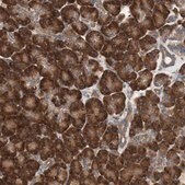 Anti-LZTS1 antibody produced in rabbit Prestige Antibodies&#174; Powered by Atlas Antibodies, affinity isolated antibody, buffered aqueous glycerol solution