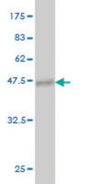 Monoclonal Anti-PIP5K1C antibody produced in mouse clone 7D11, purified immunoglobulin, buffered aqueous solution