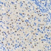 Anti-PIM1 antibody produced in rabbit