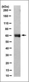 Anti-RIPK2 Antibody, clone 1H10.1 clone 1H10.1, from mouse