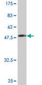 Monoclonal Anti-TPI1 antibody produced in mouse clone 2C3, ascites fluid