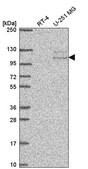 Anti-TSR1 antibody produced in rabbit Prestige Antibodies&#174; Powered by Atlas Antibodies, affinity isolated antibody