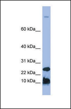 Anti-HAMP, (N-terminal) antibody produced in rabbit affinity isolated antibody