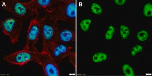Anti-HNRNPH1 Antibody, clone 1E14 ZooMAb® Rabbit Monoclonal recombinant, expressed in HEK 293 cells