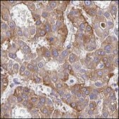 Anti-HIVEP2 antibody produced in rabbit Prestige Antibodies&#174; Powered by Atlas Antibodies, affinity isolated antibody, buffered aqueous glycerol solution