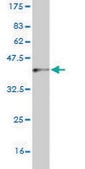 Monoclonal Anti-CNDP2 antibody produced in mouse clone 1B1, purified immunoglobulin, buffered aqueous solution