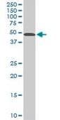 Monoclonal Anti-STK38 antibody produced in mouse clone 2F3, purified immunoglobulin, buffered aqueous solution