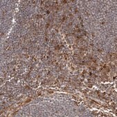 Anti-IL32 antibody produced in rabbit Prestige Antibodies&#174; Powered by Atlas Antibodies, affinity isolated antibody, buffered aqueous glycerol solution