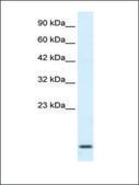Anti-HOXA1 antibody produced in rabbit IgG fraction of antiserum