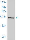 Monoclonal Anti-DC-UbP antibody produced in mouse clone 1B8-1B1, purified immunoglobulin, buffered aqueous solution