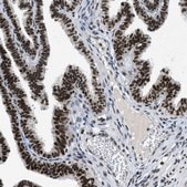 Anti-KDM3B antibody produced in rabbit Prestige Antibodies&#174; Powered by Atlas Antibodies, affinity isolated antibody, buffered aqueous glycerol solution