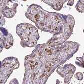 Anti-CLTA antibody produced in rabbit Prestige Antibodies&#174; Powered by Atlas Antibodies, affinity isolated antibody, buffered aqueous glycerol solution