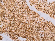 NKX2.2 (EP336) Rabbit Monoclonal Primary Antibody