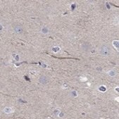 Anti-ABCG4 antibody produced in rabbit Prestige Antibodies&#174; Powered by Atlas Antibodies, affinity isolated antibody, buffered aqueous glycerol solution
