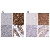 Anti-FAH antibody produced in rabbit Prestige Antibodies® Powered by Atlas Antibodies, affinity isolated antibody, buffered aqueous glycerol solution