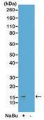 Anti-Acetyl-Histone H2A.Z (Lys7) antibody, Rabbit monoclonal recombinant, expressed in HEK 293 cells, clone RM222, purified immunoglobulin