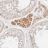Anti-TNK1 antibody produced in rabbit Prestige Antibodies&#174; Powered by Atlas Antibodies, affinity isolated antibody, buffered aqueous glycerol solution