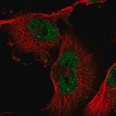 Anti-ZXDB antibody produced in rabbit Prestige Antibodies® Powered by Atlas Antibodies, affinity isolated antibody, buffered aqueous glycerol solution