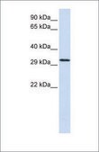 Anti-C21ORF2 antibody produced in rabbit affinity isolated antibody