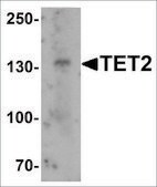 Anti-TET2 antibody produced in rabbit affinity isolated antibody