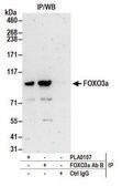 Rabbit anti-FOXO3a Antibody, Affinity Purified Powered by Bethyl Laboratories, Inc.