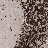 Monoclonal Anti-PARP1 Prestige Antibodies&#174; Powered by Atlas Antibodies, clone CL2209, purified immunoglobulin, buffered aqueous glycerol solution