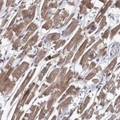 Anti-TPCN1 antibody produced in rabbit Prestige Antibodies® Powered by Atlas Antibodies, affinity isolated antibody, buffered aqueous glycerol solution