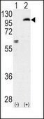 Anti-PKCε (N-term) antibody produced in rabbit IgG fraction of antiserum, buffered aqueous solution