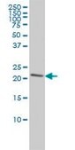 Monoclonal Anti-PRDX2 antibody produced in mouse clone 4E10-2D2, purified immunoglobulin, buffered aqueous solution