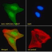 Anti-HSPC150/UBE2T antibody produced in goat affinity isolated antibody, buffered aqueous solution