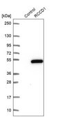 Anti-RCCD1 antibody produced in rabbit Prestige Antibodies&#174; Powered by Atlas Antibodies, affinity isolated antibody, buffered aqueous glycerol solution