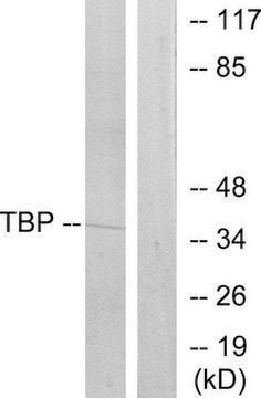 Anti-TBP antibody produced in rabbit affinity isolated antibody